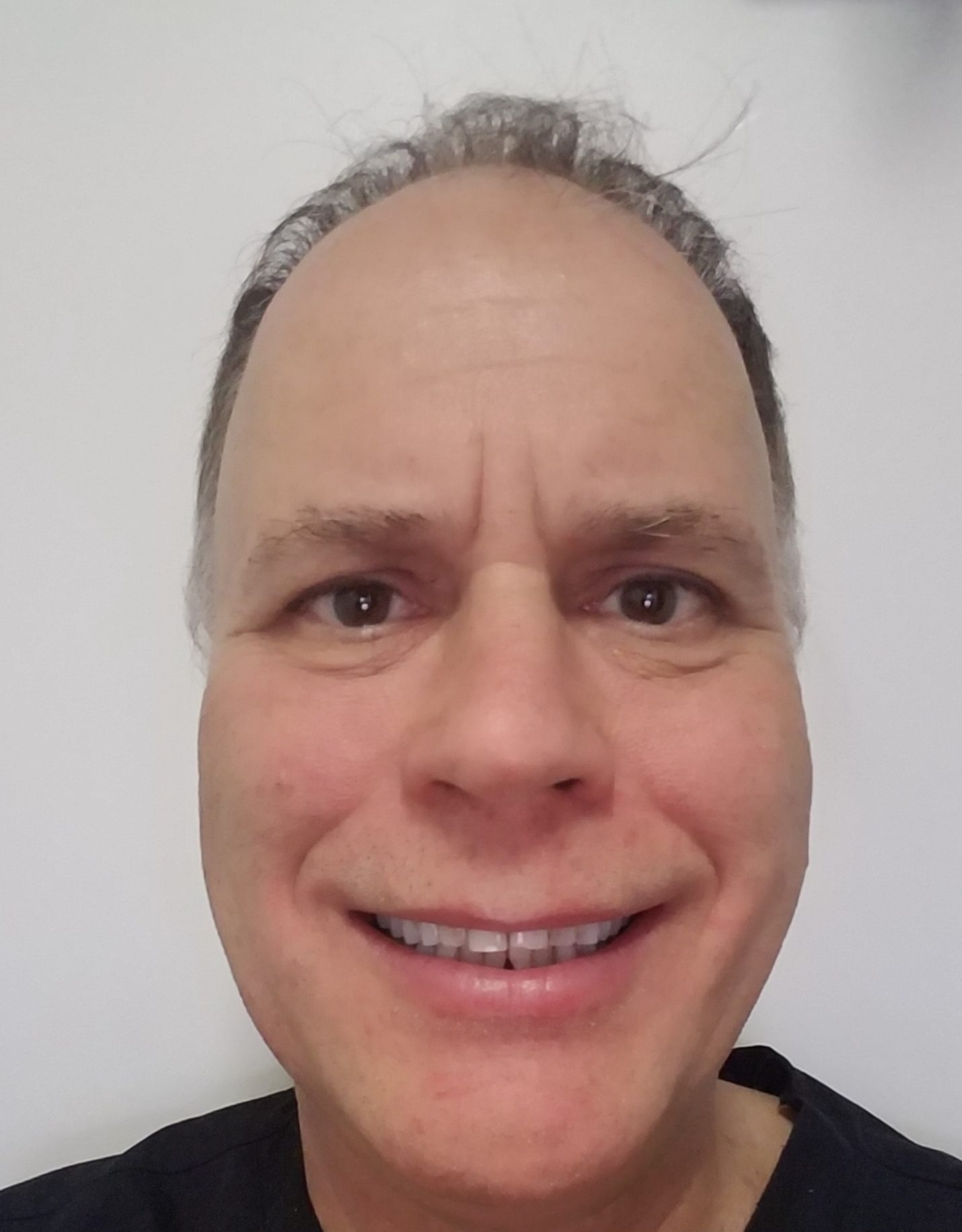 Dr. Geoffrey Buncke, MD (1)